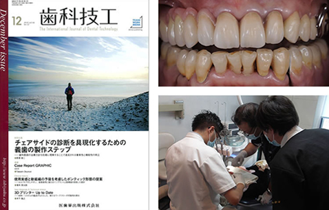 歯科技工